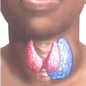 Узловая гиперплазия щитовидной железы